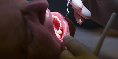 Зубосохраняющие операции фото