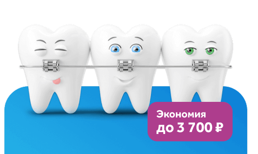 Исправление прикуса детям