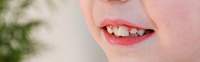 Что делать, если у ребенка криво растут зубы? фото