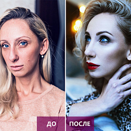 И миллиона не жалко: героиня проекта по преображению обрела внешность мечты, фото 2
