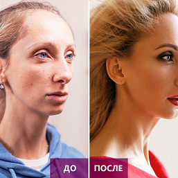 И миллиона не жалко: героиня проекта по преображению обрела внешность мечты, фото 4