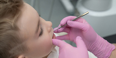 Детская терапевтическая стоматология фото