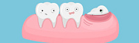 Зубы мудрости: удалить или вылечить? фото