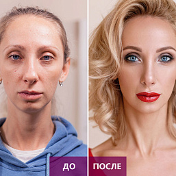 Стоматологическая клиника И миллиона не жалко: героиня проекта по преображению обрела внешность мечты фото 2