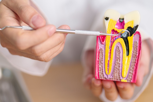 Воспаление нерва